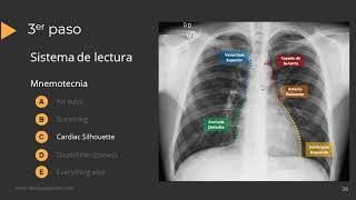 Tutorial Radiografía de Torax [upl. by Mailliw]