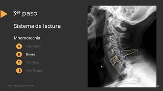 Radiografía de Columna Paso a Paso [upl. by Hachman969]