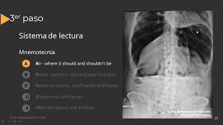 Radiografía de Abdomen Paso a Paso [upl. by Condon]