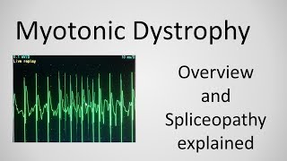 Myotonic Dystrophy and Spliceopathy explained [upl. by Kele]