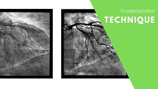 Fluoroscopic Technique [upl. by Armbruster]