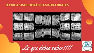 Técnicas Radiográficas Intraorales Periapical o Retroalveolar  Bite wing  oclusal [upl. by Leirrad]