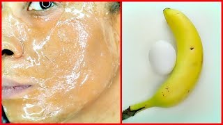 APPLY BANANA AND EGG ON YOUR SKIN ANTI  AGING REDUCE WRINKLES SPOTLESS FIRM SKIN Khichi Beauty [upl. by Derfniw]