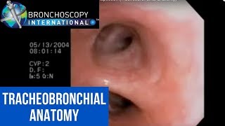 Flexible Bronchoscopy Introduction 7  Airway Inspection Tracheobronchial Anatomy [upl. by Lramaj]