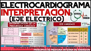 ELECTROCARDIOGRAMA INTERPRETACIÓN  GuiaMed [upl. by Yeta]