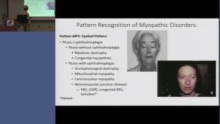 RRNMF  Pattern Recognition of Myopathic Disorders [upl. by Axe]