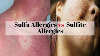 Sulfa Allergies vs Sulfite Allergies [upl. by Neelrahc]