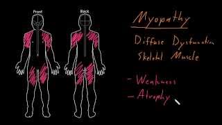 Syndrome Myopathy [upl. by Aicrag118]