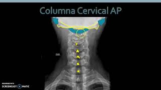 Anatomía Radiológica Columna Cervical [upl. by Winifred]